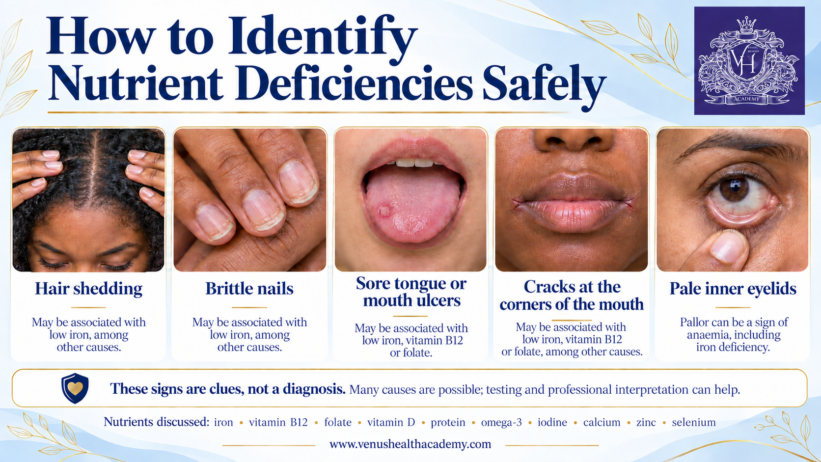 Infographic showing hair shedding, brittle nails, mouth ulcers, cracked mouth corners and pale inner eyelids as possible nutrient-deficiency clues across diverse skin tones.
